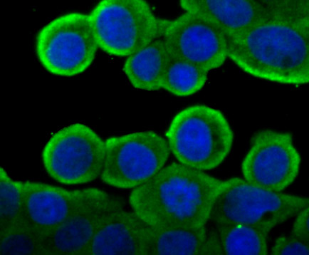 Cytochrome P450 Reductase Rabbit mAb