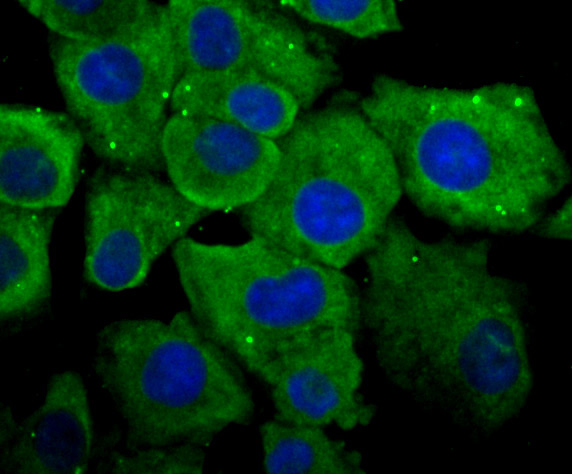 Cytochrome P450 Reductase Rabbit mAb