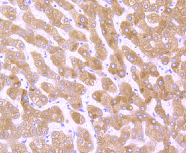 Cytochrome P450 Reductase Rabbit mAb