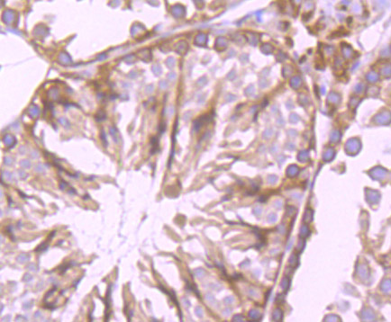 Cytochrome P450 Reductase Rabbit mAb