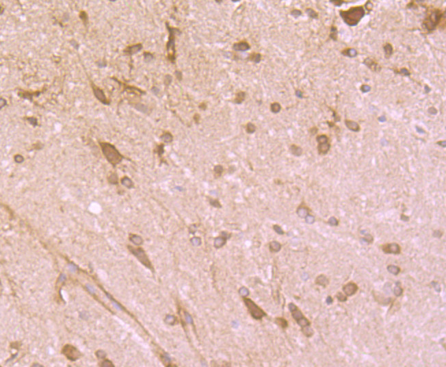 Cytochrome P450 Reductase Rabbit mAb