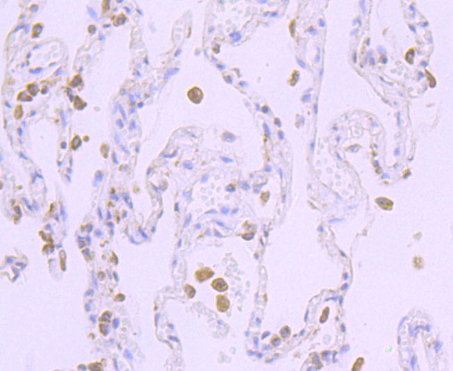 Cytochrome P450 Reductase Rabbit mAb