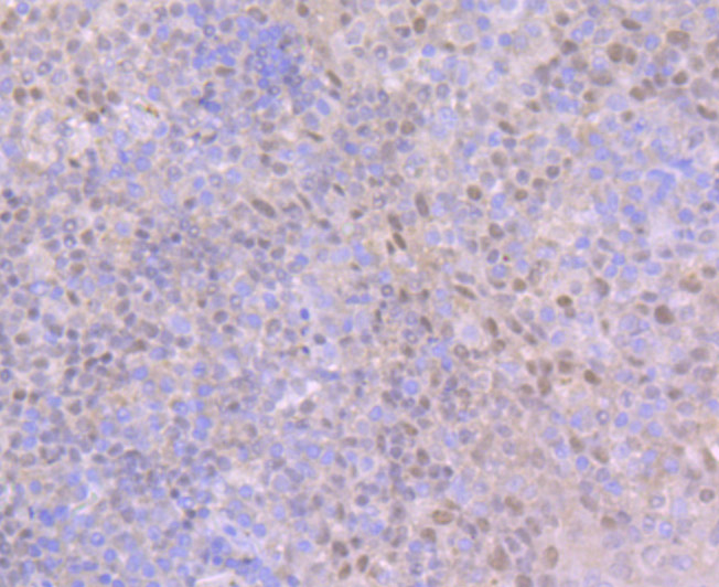 Ctip1 Rabbit mAb