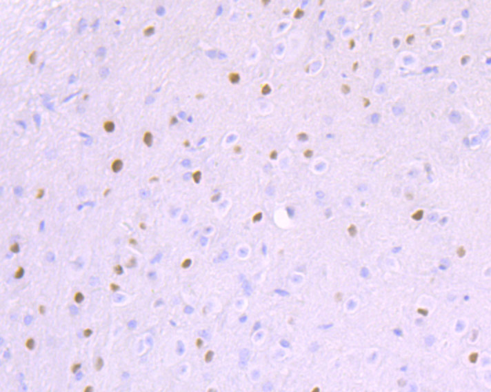 Ctip1 Rabbit mAb