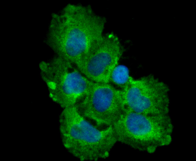 TGF alpha Rabbit mAb