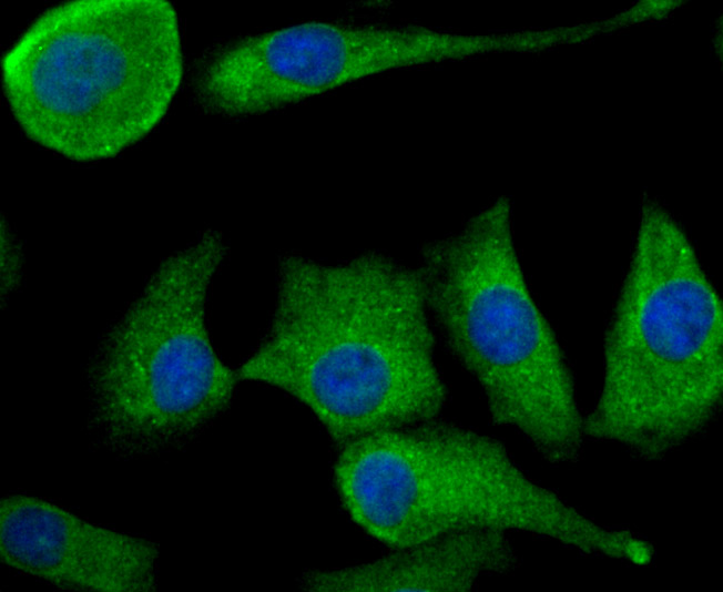 TGF alpha Rabbit mAb