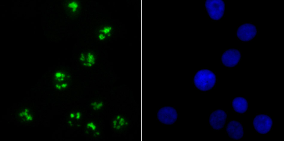 KDM5A Rabbit mAb