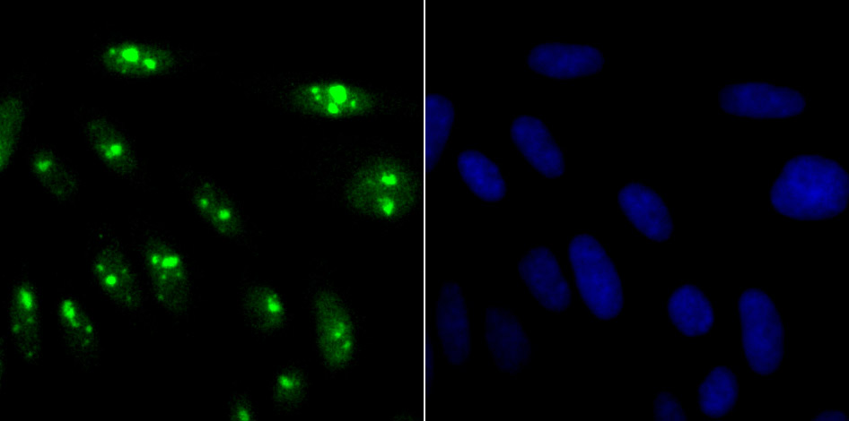 KDM5A Rabbit mAb