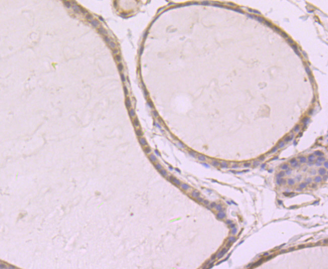 SRC1 Rabbit mAb