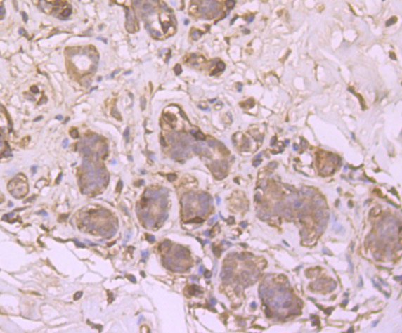 SRC1 Rabbit mAb