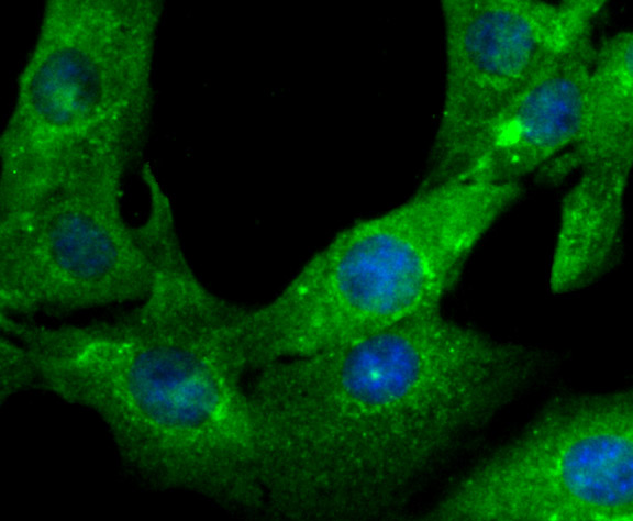 Gelsolin Rabbit mAb