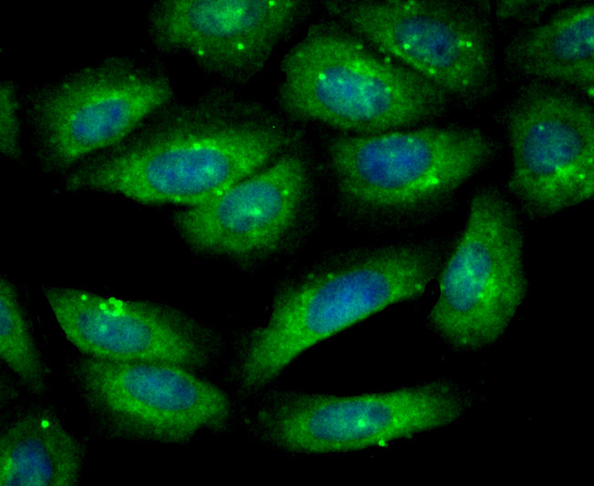 Gelsolin Rabbit mAb