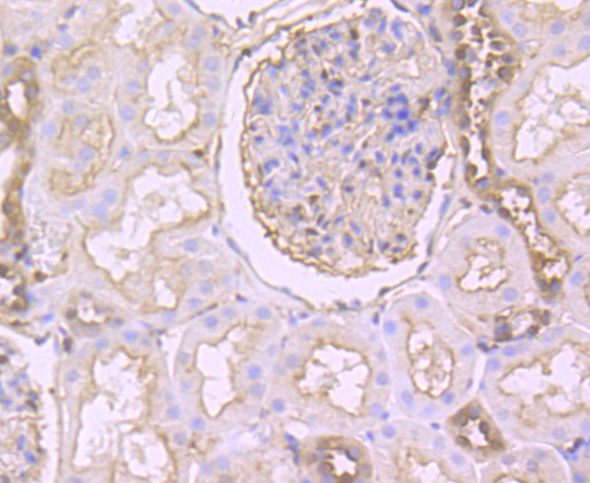 Gelsolin Rabbit mAb