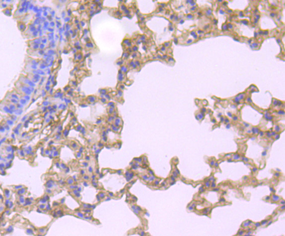 Gelsolin Rabbit mAb