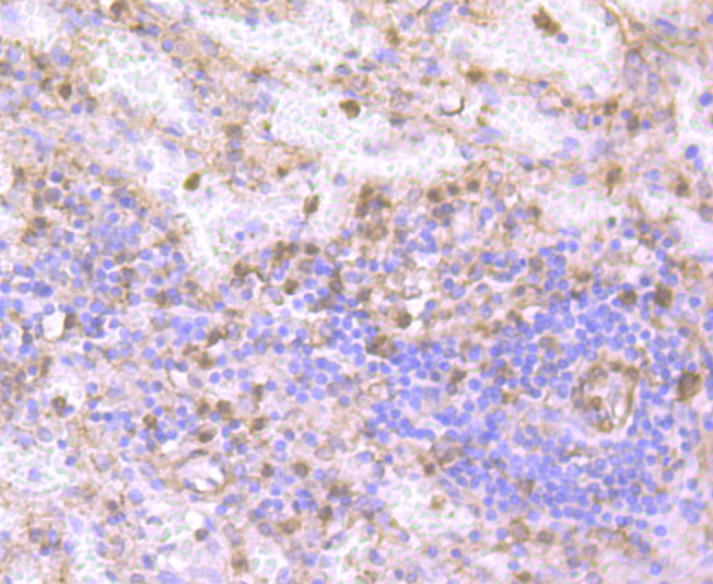 Gelsolin Rabbit mAb