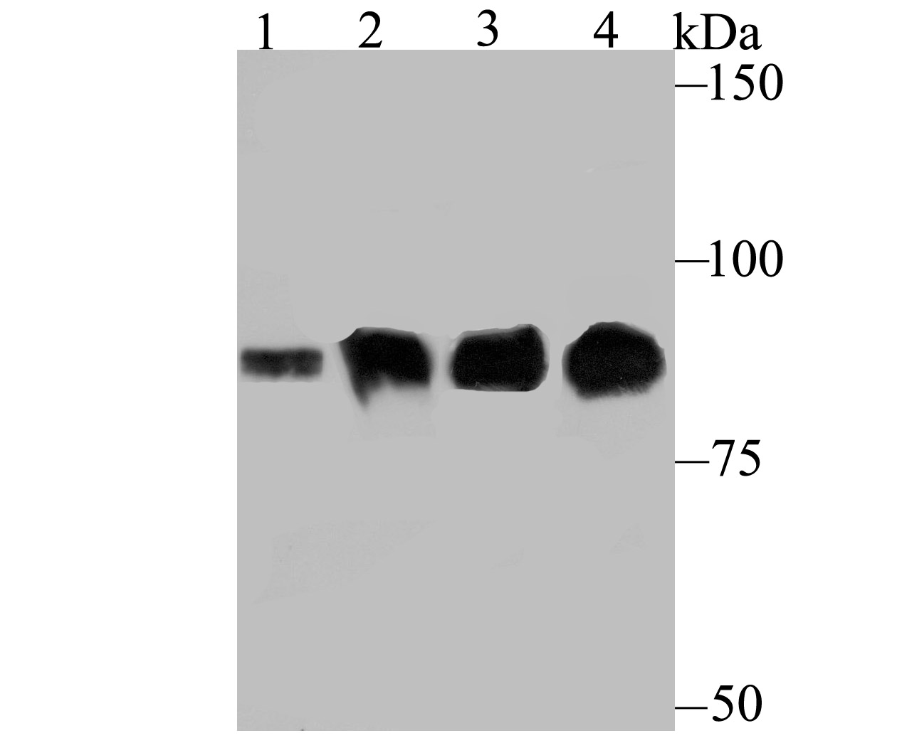 Gelsolin Rabbit mAb