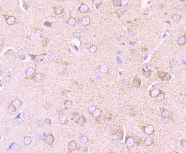 PDK2 Rabbit mAb