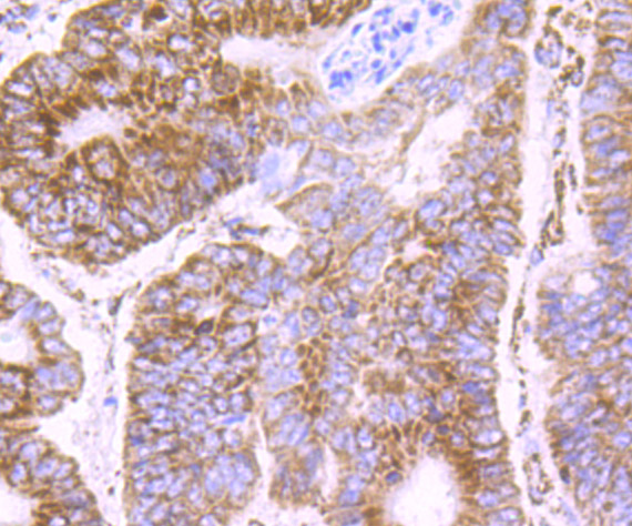 PDK2 Rabbit mAb