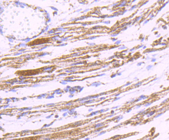 PDK2 Rabbit mAb