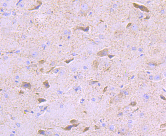 PDK2 Rabbit mAb