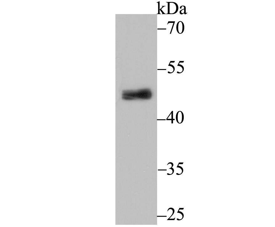 PDK2 Rabbit mAb