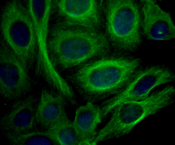 Apolipoprotein A II Rabbit mAb