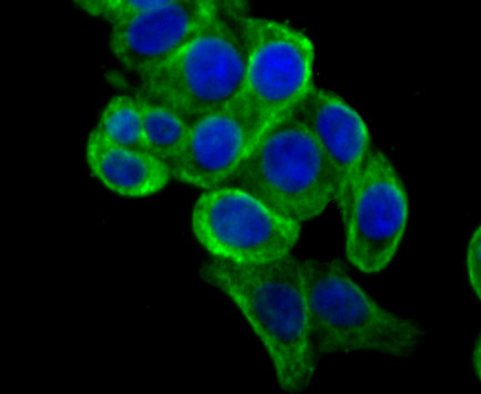 Apolipoprotein A II Rabbit mAb