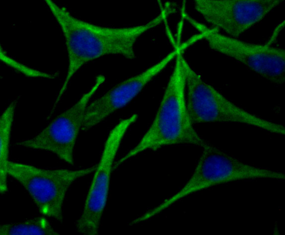 Apolipoprotein A II Rabbit mAb