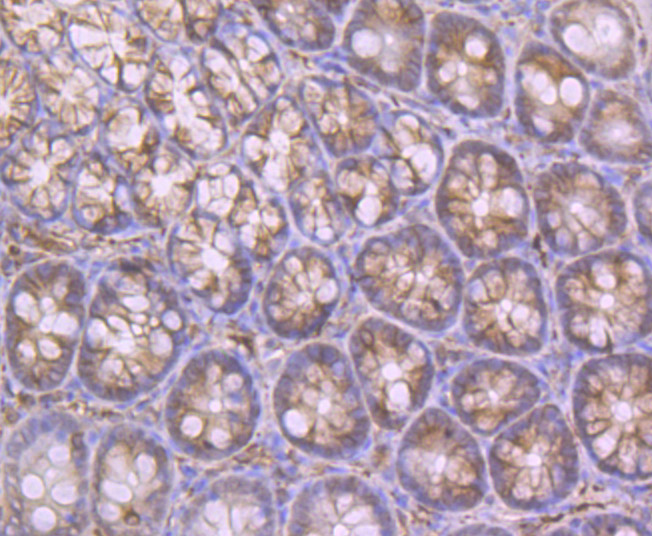 Apolipoprotein A II Rabbit mAb