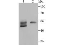 Biglycan Rabbit mAb