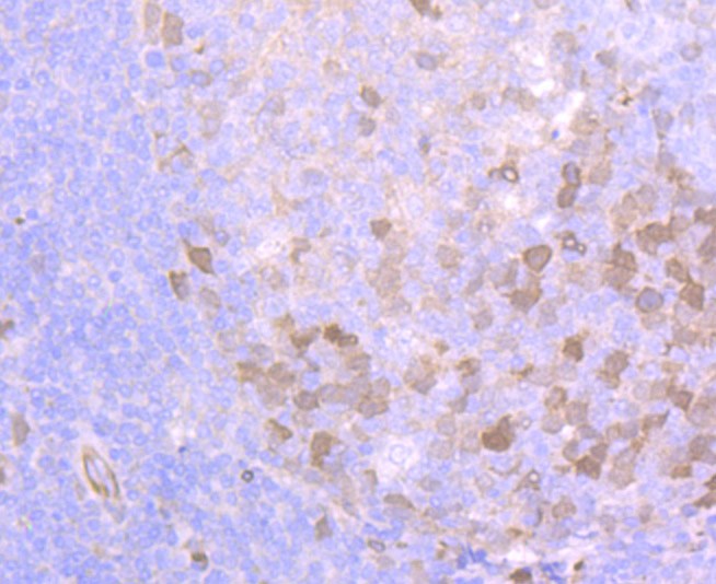 Securin Rabbit mAb