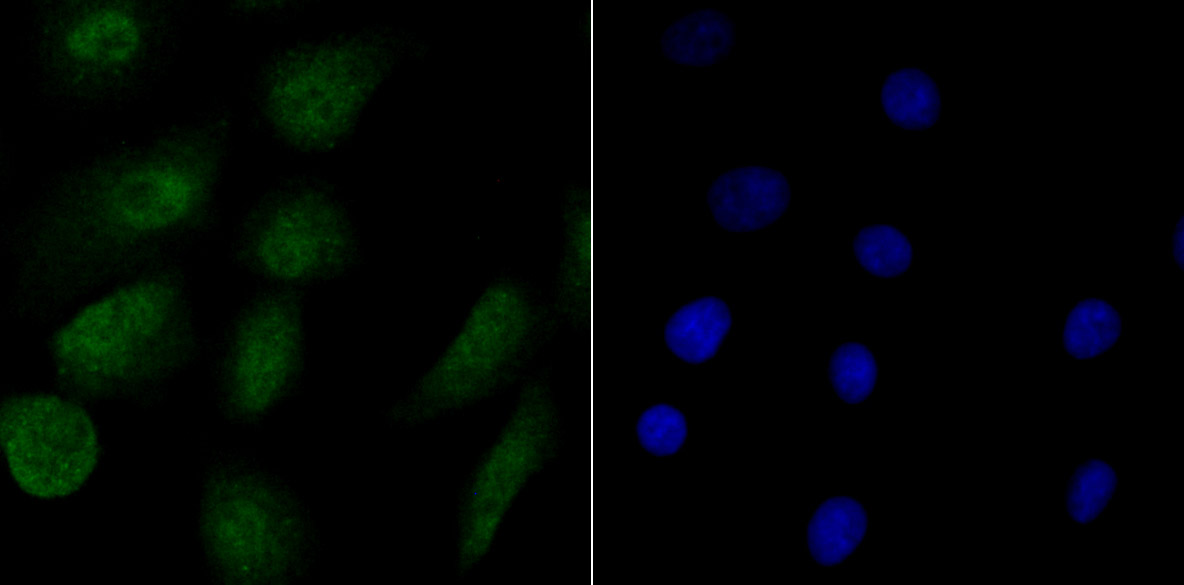 RPA70 Rabbit mAb