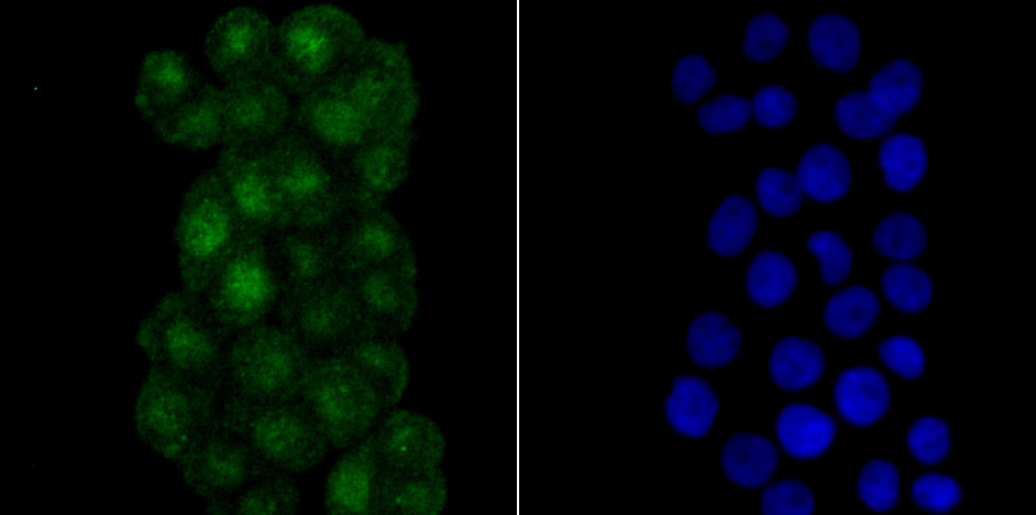 RPA70 Rabbit mAb