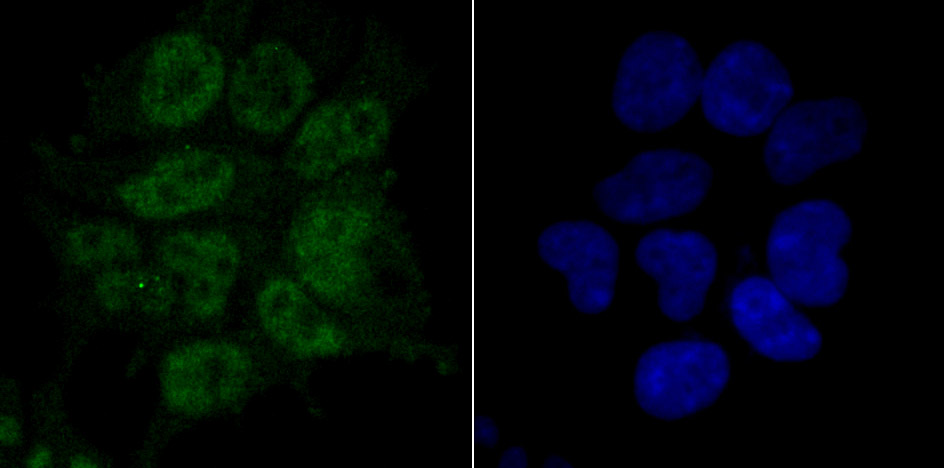 RPA70 Rabbit mAb