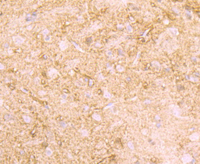 Creatine kinase B type Rabbit mAb