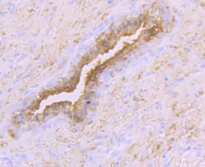 Creatine kinase B type Rabbit mAb