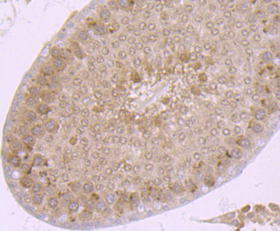 Proteasome 20S C2 Rabbit mAb