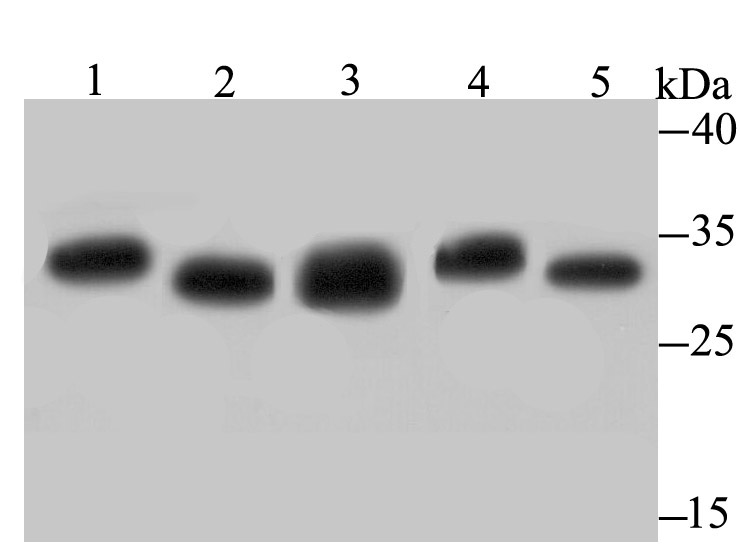 Proteasome 20S C2 Rabbit mAb