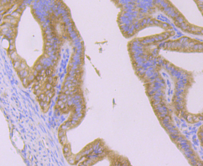 Huntingtin Rabbit mAb