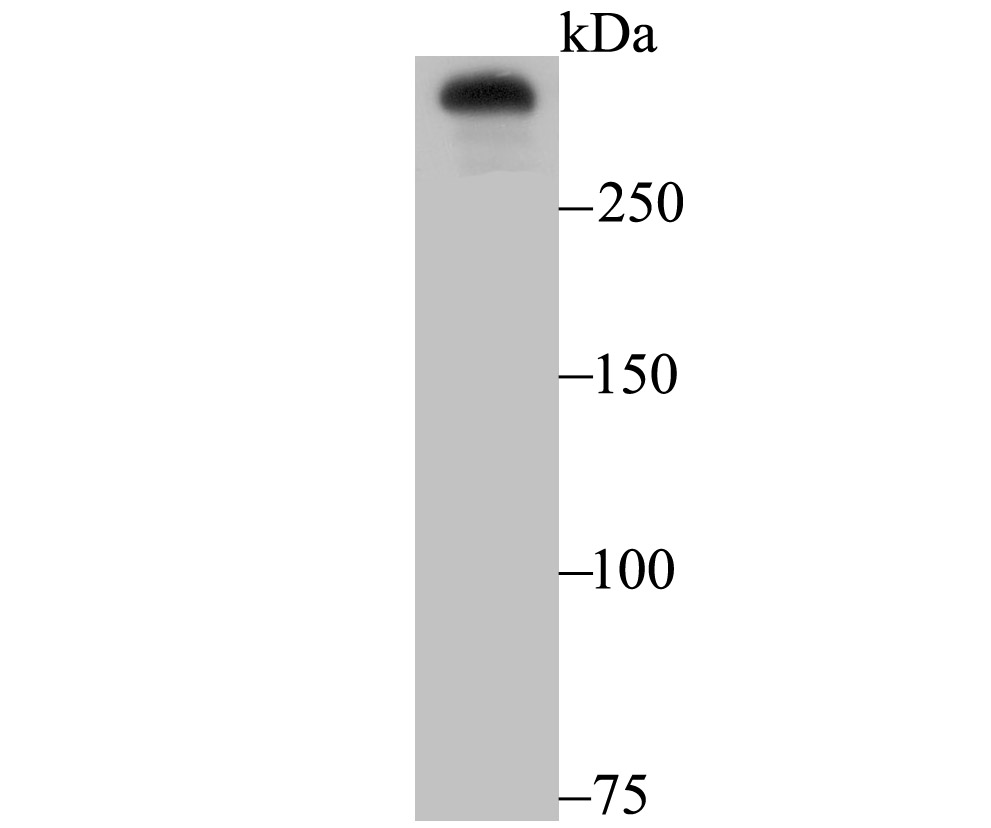 Huntingtin Rabbit mAb