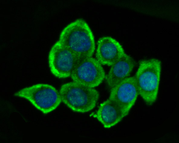 Glutathione Synthetase Rabbit mAb