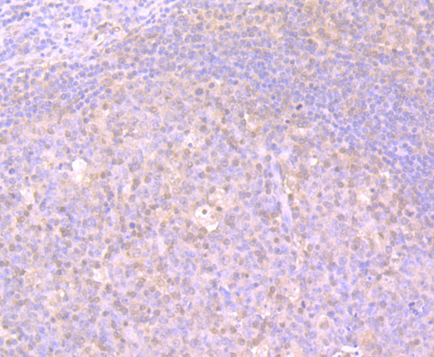 Glutathione Synthetase Rabbit mAb