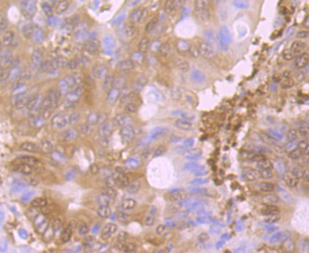 Glutathione Synthetase Rabbit mAb