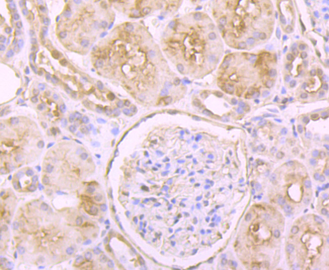 Glutathione Synthetase Rabbit mAb