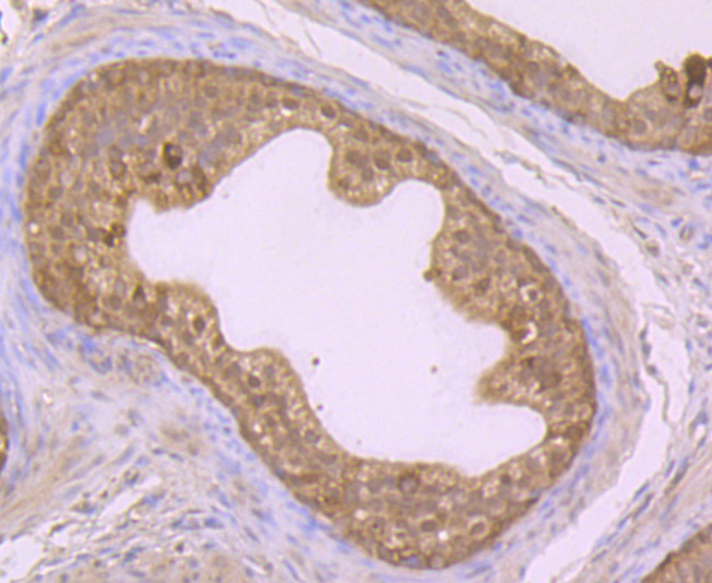 Glutathione Synthetase Rabbit mAb