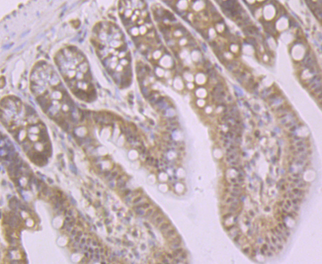 Glutathione Synthetase Rabbit mAb