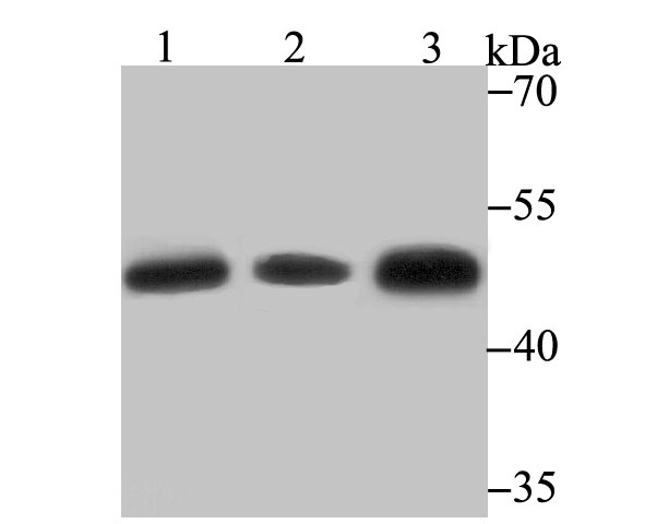 Glutathione Synthetase Rabbit mAb