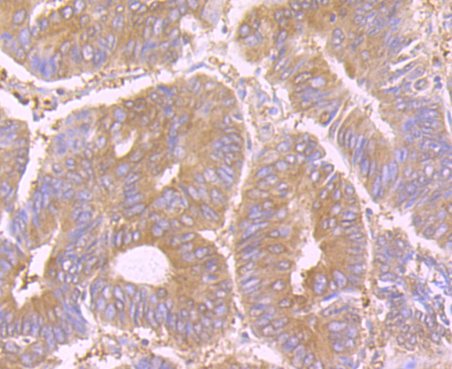 STIP1 Rabbit mAb