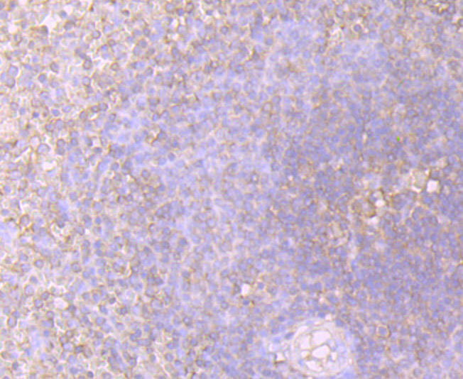 STIP1 Rabbit mAb