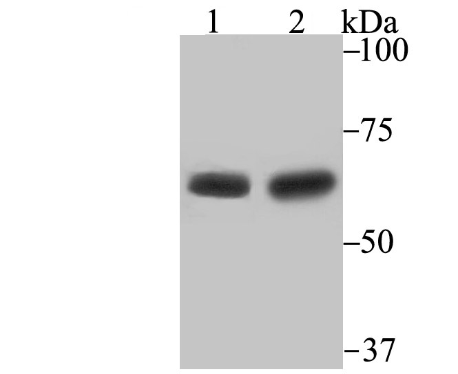 STIP1 Rabbit mAb